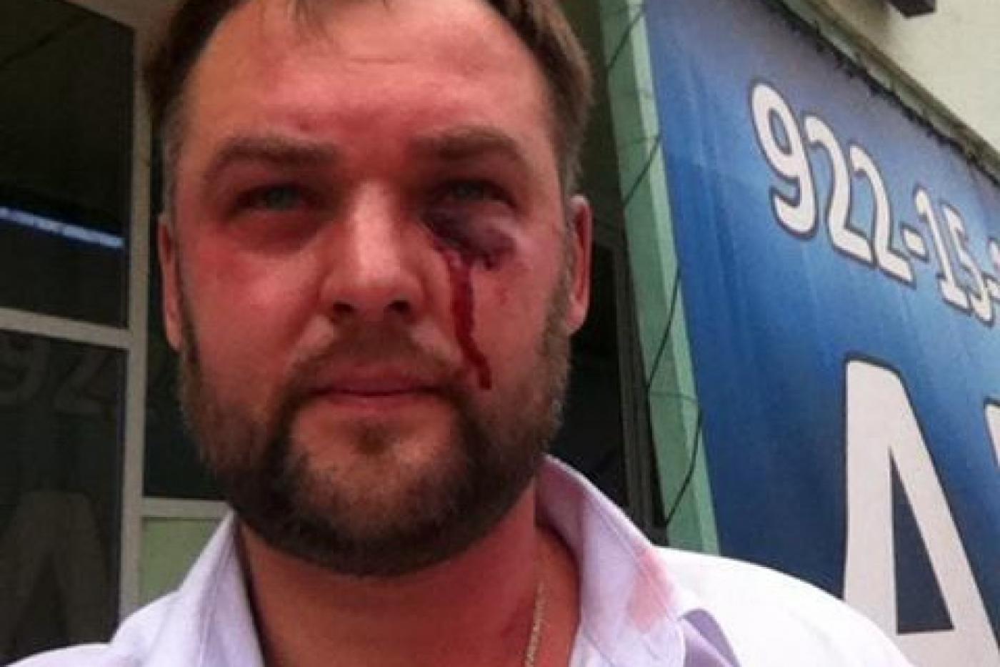 Агрессивные сотрудники автосервиса могут лишить юриста Волкова мандата депутата заксо - Фото 1