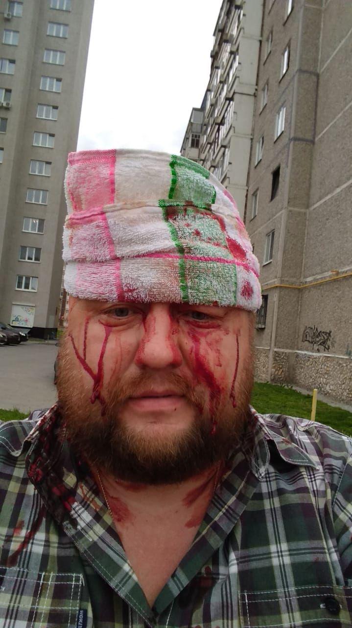 В Екатеринбурге избили директора компании «Средураллифт», у которого был конфликт с крупной УК. ФОТО - Фото 2