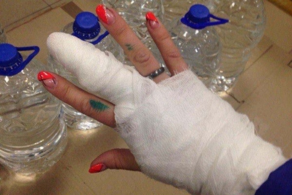 Оператор Дом.ru не пришел на суд с девушкой, руку которой порезало дроном - Фото 1
