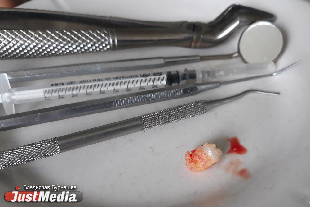 К чему снится выпадение зубов - Фото 1